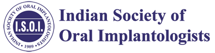 ISOI Logo